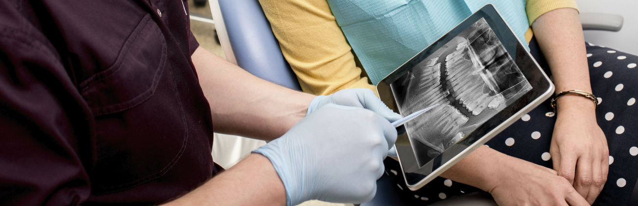 3 Advantages of CAD/CAM Restorations